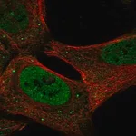 Merck Anti-USP3 antibody produced in rabbit