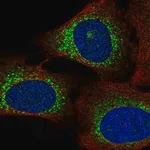 Merck Anti-WISP3 antibody produced in rabbit