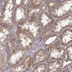 Merck Anti-TRMU antibody produced in rabbit