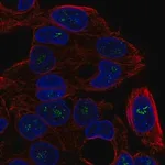 Merck Anti-ICK antibody produced in rabbit
