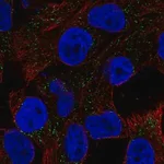 Merck Anti-CSAG1 antibody produced in rabbit