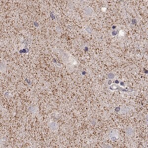 Merck Anti-SLC6A3 antibody produced in rabbit