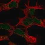 Merck Anti-PHF14 antibody produced in rabbit