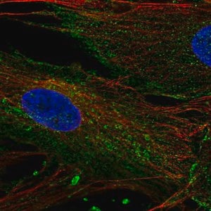 Merck Anti-CHIC2 antibody produced in rabbit