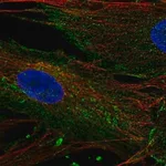 Merck Anti-CHIC2 antibody produced in rabbit