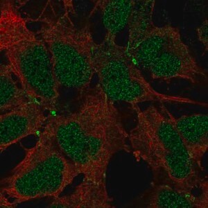 Merck Anti-JAM2 antibody produced in rabbit