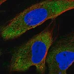 Merck Anti-YTHDF2 antibody produced in rabbit