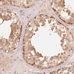 Merck Anti-PARK2 antibody produced in rabbit