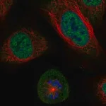 Merck Anti-SGO1 antibody produced in rabbit