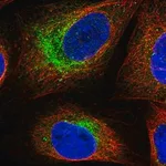 Merck Anti-SCN3B antibody produced in rabbit