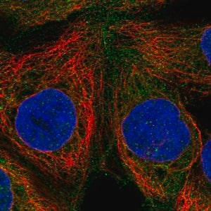 Merck Anti-RASGRP1 antibody produced in rabbit