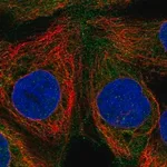 Merck Anti-RASGRP1 antibody produced in rabbit