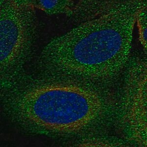 Merck Anti-TBC1D2B antibody produced in rabbit