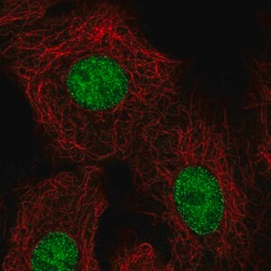 Merck Anti-HOXB5 antibody produced in rabbit