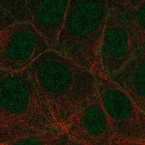Merck Anti-FLT4 antibody produced in rabbit