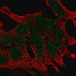 Merck Anti-WNT2B antibody produced in rabbit
