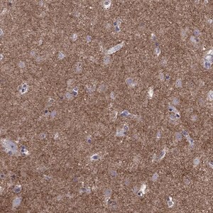 Merck Anti-GNAL antibody produced in rabbit