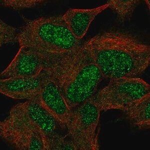 Merck Anti-KIAA0408 antibody produced in rabbit