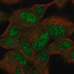 Merck Anti-KIAA0408 antibody produced in rabbit