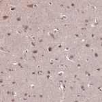 Merck Anti-WDR17 antibody produced in rabbit