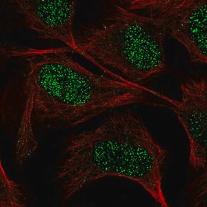 Merck Anti-GUCY1A3 antibody produced in rabbit