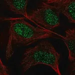 Merck Anti-GUCY1A3 antibody produced in rabbit