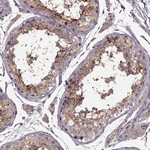 Merck Anti-SLC52A3 antibody produced in rabbit