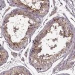 Merck Anti-SLC52A3 antibody produced in rabbit