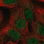 Merck Anti-NR2F2 antibody produced in rabbit
