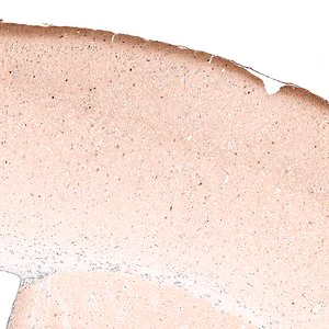 Merck Monoclonal Anti-RELN antibody produced in mouse