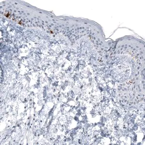 Merck Monoclonal Anti-TYRP1 antibody produced in mouse