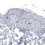 Merck Monoclonal Anti-TYRP1 antibody produced in mouse