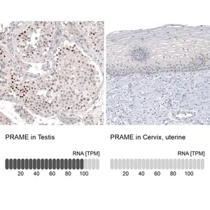 Merck Monoclonal Anti-PRAME antibody produced in mouse
