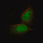 Merck Monoclonal Anti-PRAME antibody produced in mouse