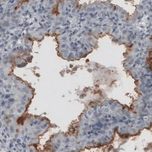 Merck Monoclonal Anti-MUC16 antibody produced in mouse