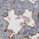 Merck Monoclonal Anti-MUC16 antibody produced in mouse