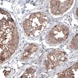 Merck Monoclonal Anti-BRAF antibody produced in mouse