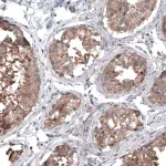 Merck Monoclonal Anti-BRAF antibody produced in mouse