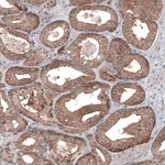 Merck Monoclonal Anti-BRAF antibody produced in mouse