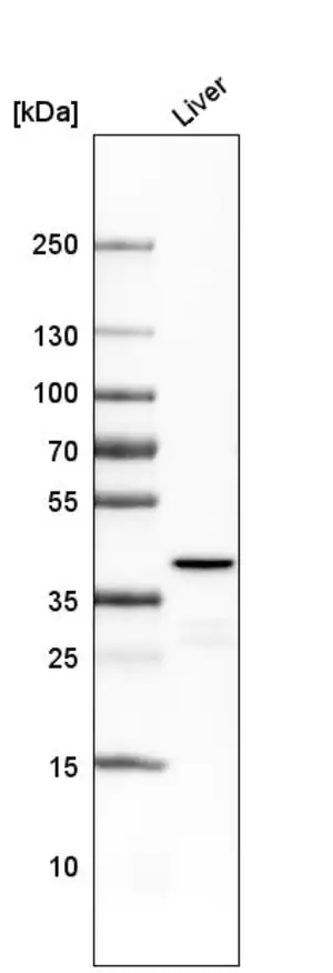 Merck Monoclonal Anti-OTC antibody produced in mouse