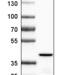 Merck Monoclonal Anti-OTC antibody produced in mouse