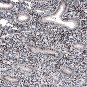 Merck Monoclonal Anti-METTL14 antibody produced in mouse
