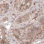 Merck Monoclonal Anti-USP30 antibody produced in mouse