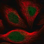 Merck Anti-ARHGAP23 antibody produced in rabbit