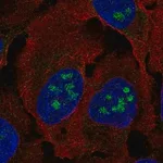 Merck Anti-BLCAP antibody produced in rabbit