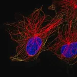 Merck Anti-ACTR1A antibody produced in rabbit