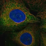 Merck Anti-FLT3 antibody produced in rabbit