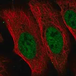 Merck Anti-CDADC1 antibody produced in rabbit