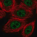 Merck Anti-VDR antibody produced in rabbit