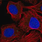 Merck Anti-AEBP1 antibody produced in rabbit